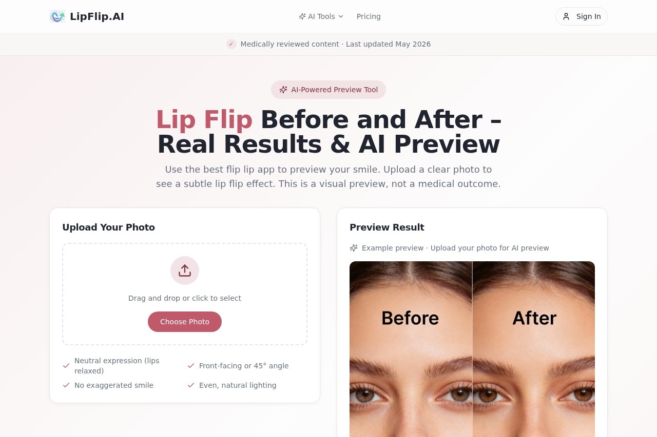 image for Lip Flip